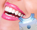 DentalPolisher®, DentalPolisher® voor thuis maakt korte metten met tandsteen en tandplak