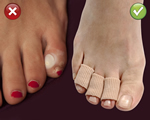 ToeCushion®, comfortsenior, gezond & fit, Bescherm en verzacht uw gevoelige en pijnlijke tenen met gel kussentjes