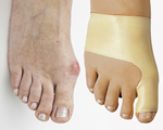 FootCorrectors® set van 2, comfortsenior, gezond & fit, FootCorrector® brengt uw grote teen weer in de anatomisch juiste positie